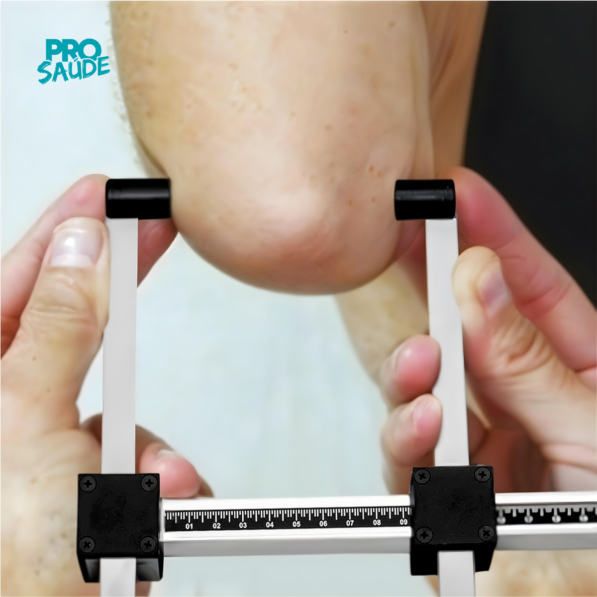 Paquímetro Em Alumínio 21cm Medição Corpo...